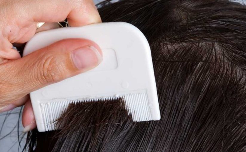  Šampon za vaške: da nestanu brzinom svetlosti!