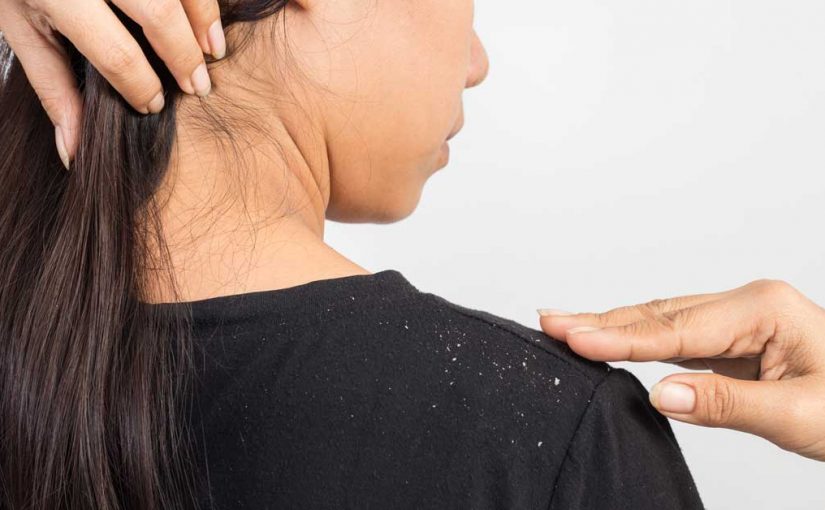  Prirodni lek za perut. Ovo su najbolji recepti!