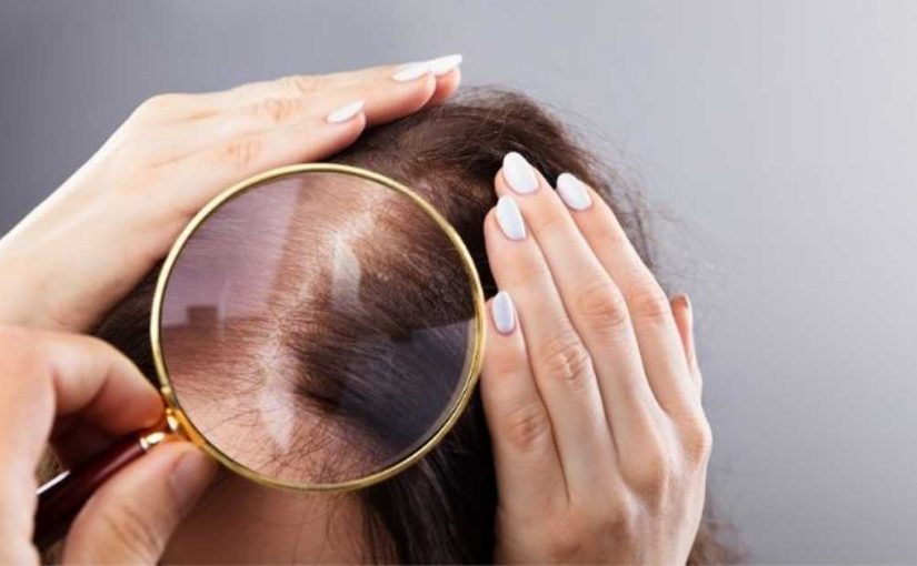  Proređivanje kose odmah možete zaustaviti! Evo i načina!