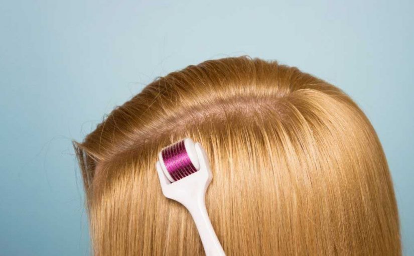  Pomaže li dermaroler za kosu kod opadanja?