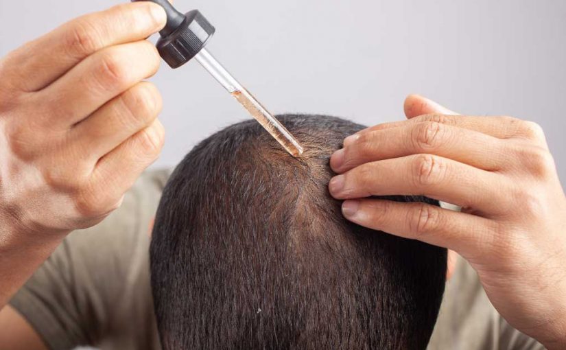  Minoksidil za kosu: Vodič kroz upotrebu i efekte