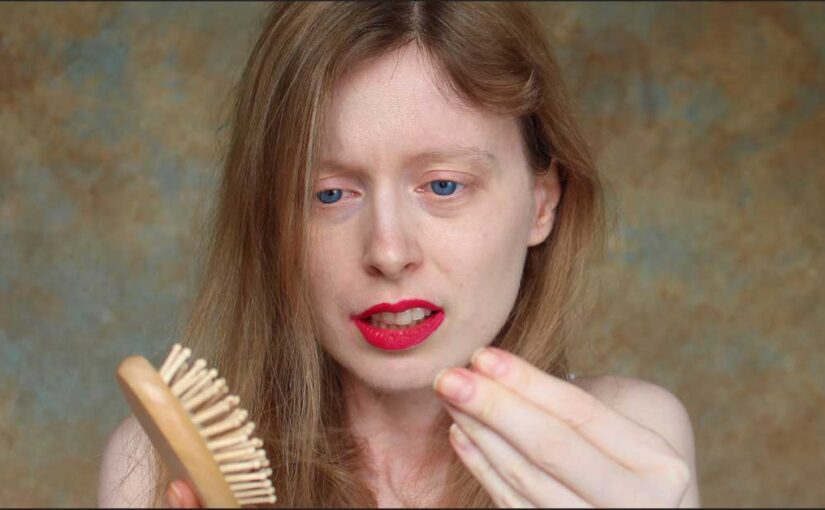  Trakciona alopecija i frizure koje te ostavljaju bez kose!